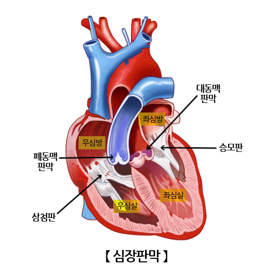 심장판막