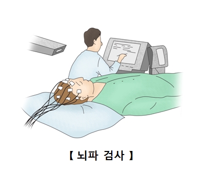 뇌파 검사