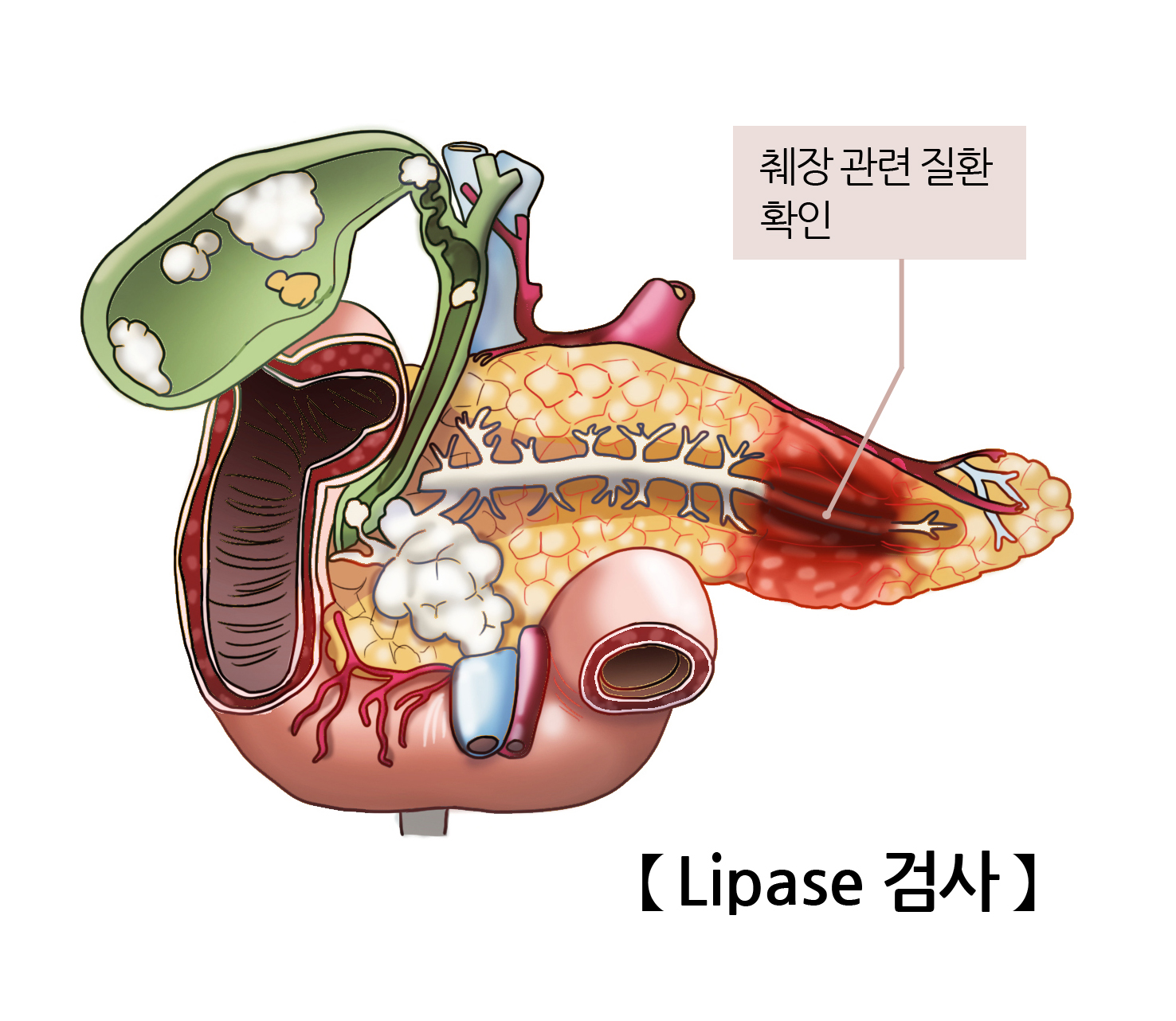 리파아제