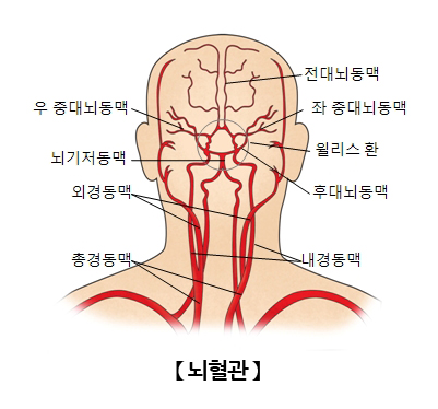 뇌혈관