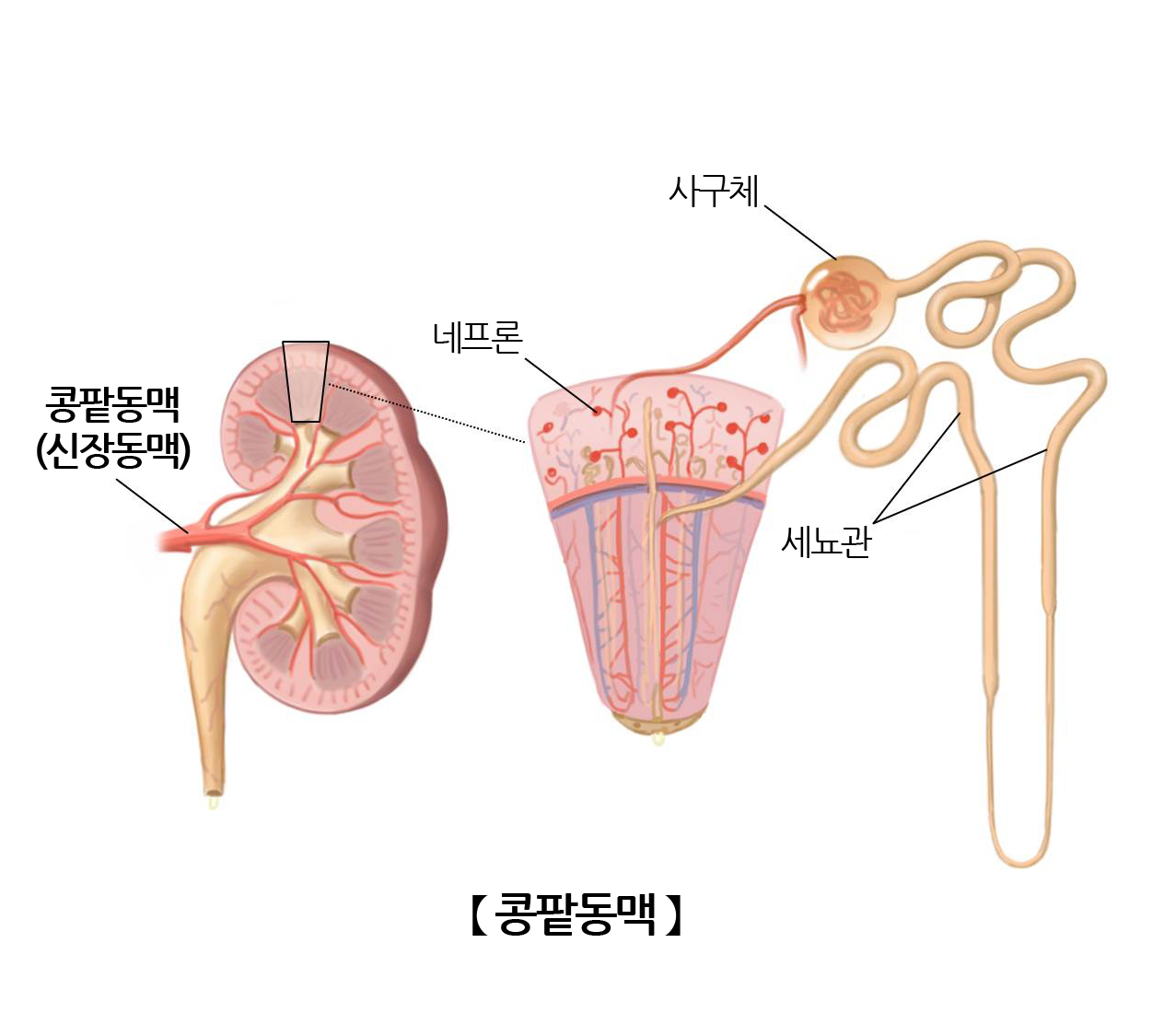 콩팥동맥