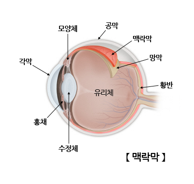 맥락막